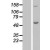 Western Blot: ABAT Lysate [NBL1-07170] - Western Blot experiments.  Left-Control; Right -Over-expression Lysate for ABAT.